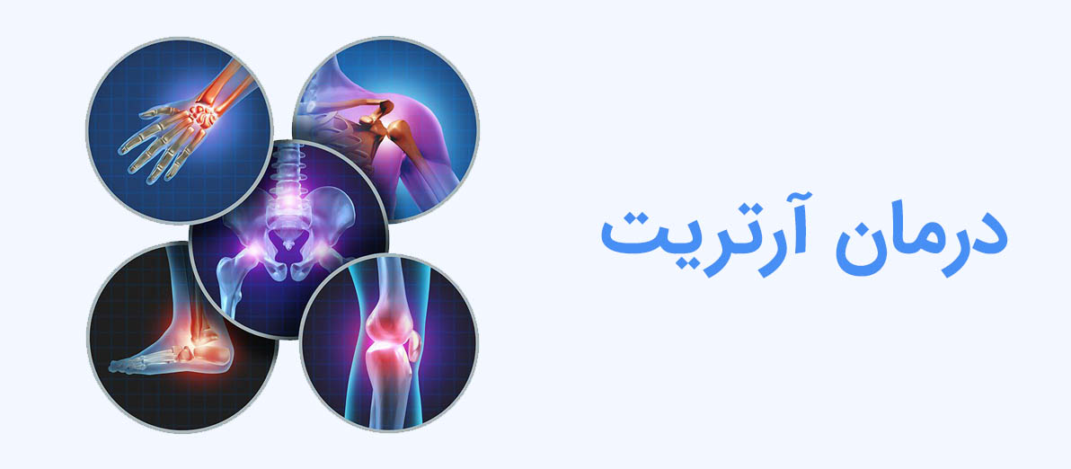 درمان آرتریت