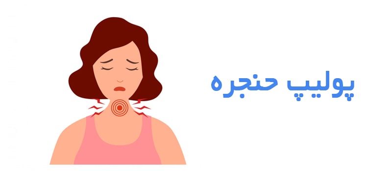 آشنایی با پولیپ حنجره