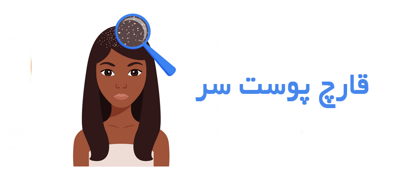 قارچ پوست سر