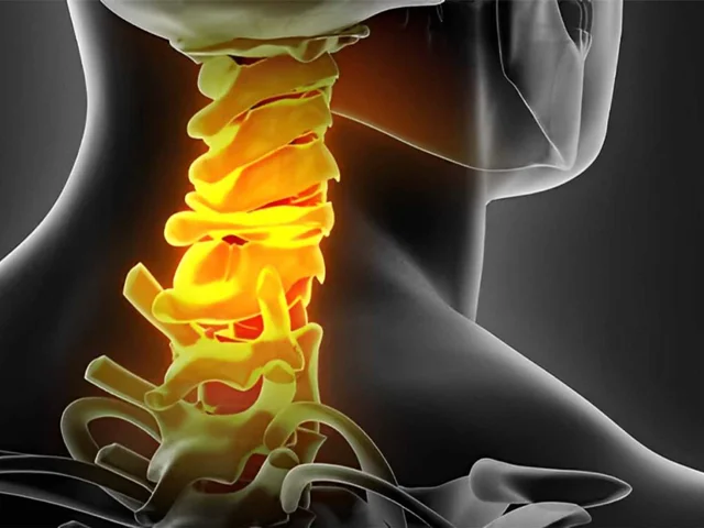 شایع ترین علائم دیسک گردن را بشناسید.