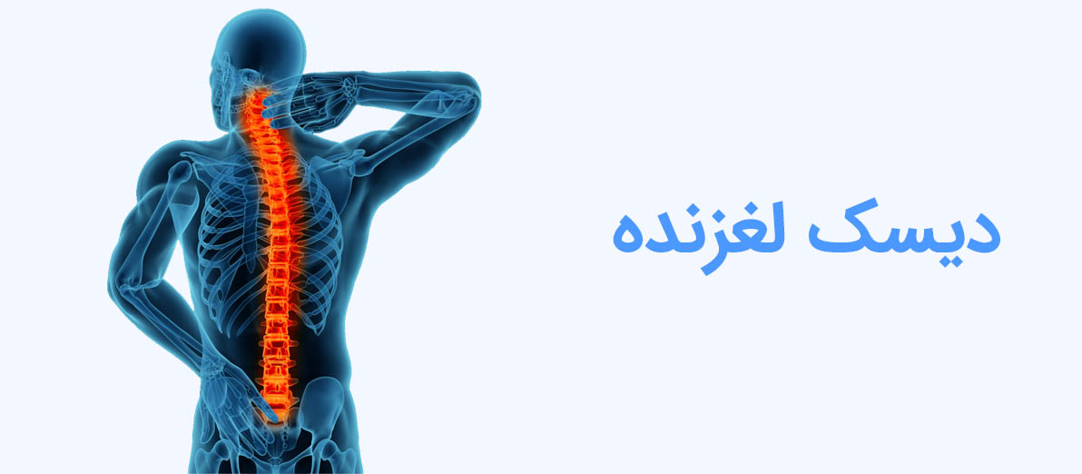 دیسک لغزنده