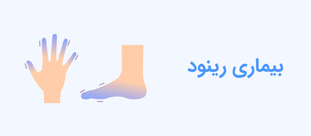 بیماری رینود