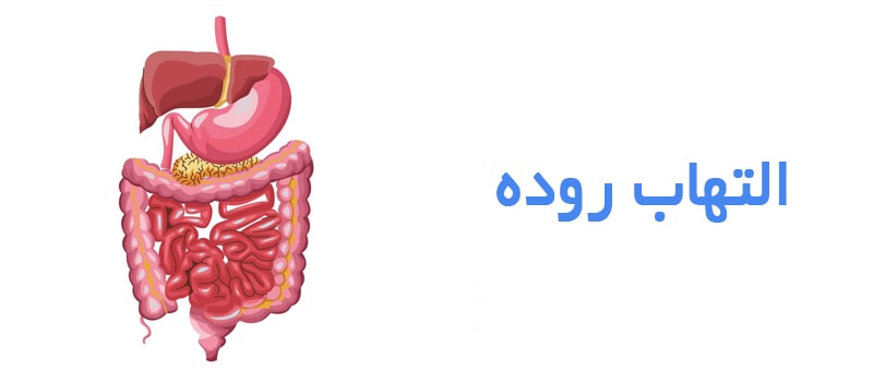 التهاب روده