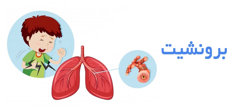 با برونشیت آشنا شویم.