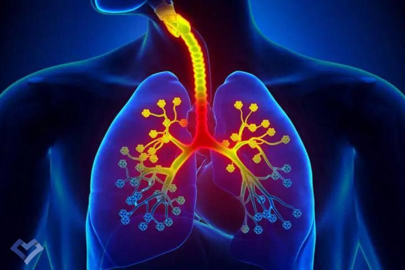 برونشیت چیست؟